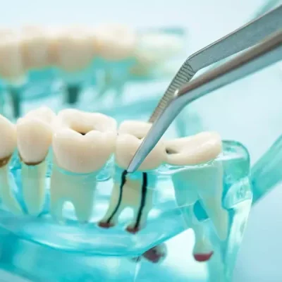 dental-teeth-model-with-dentist-tool-for-dentistry-2026-01-09-11-53-21-utc-rjiuqa2y736jejhwu4l1zhhkkonjhu85pvpo0yfqg0