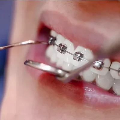 dentists-check-the-teeth-and-braces-the-patients-i-2026-01-07-00-11-44-utc-rjiuq95409592xj9zm6fezq3zas6a54fdr26joh4m8
