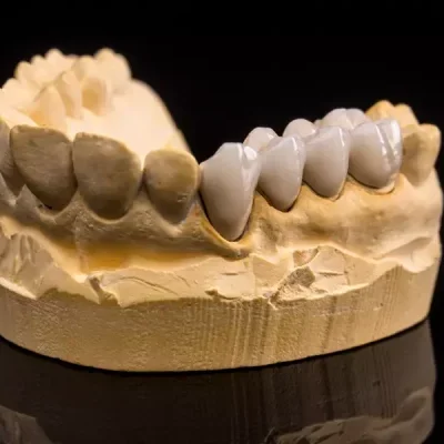 false-teeth-2026-01-08-05-40-32-utc-rjiuq3i2v8xj59rgwjqo015cezjyzyi1cz59o0phnk